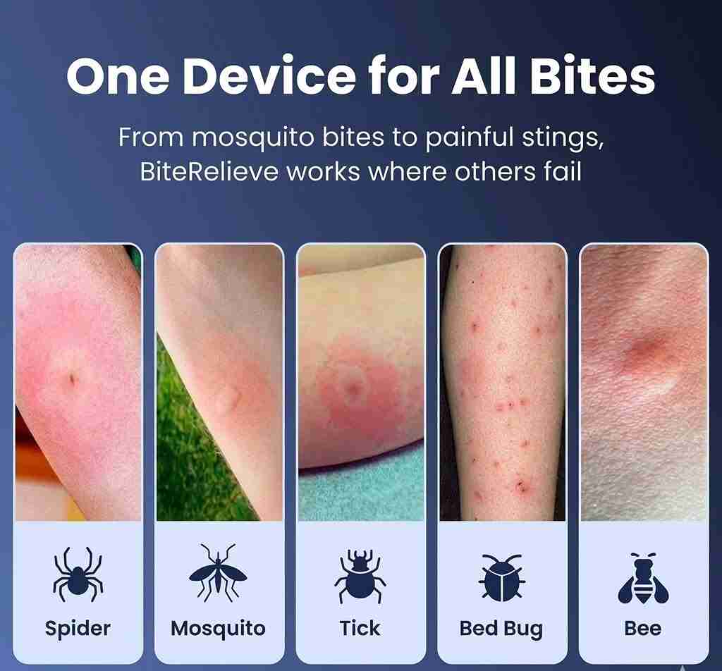 BiteRelieve Insektenstich-Behandlung