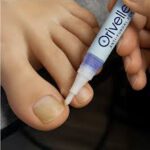 Orivelle Fungus Pen