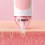 PMD Microderm