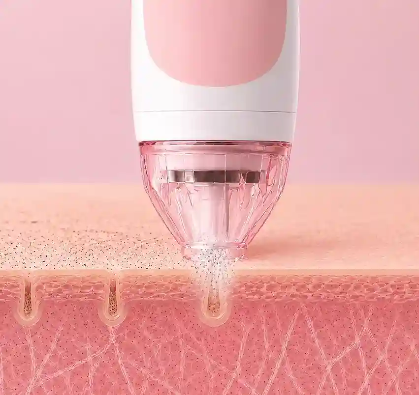 PMD Microderm